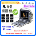 MSLCU28I vascular doppler ultrasound machine & 3d 4d color doppler ultrasound